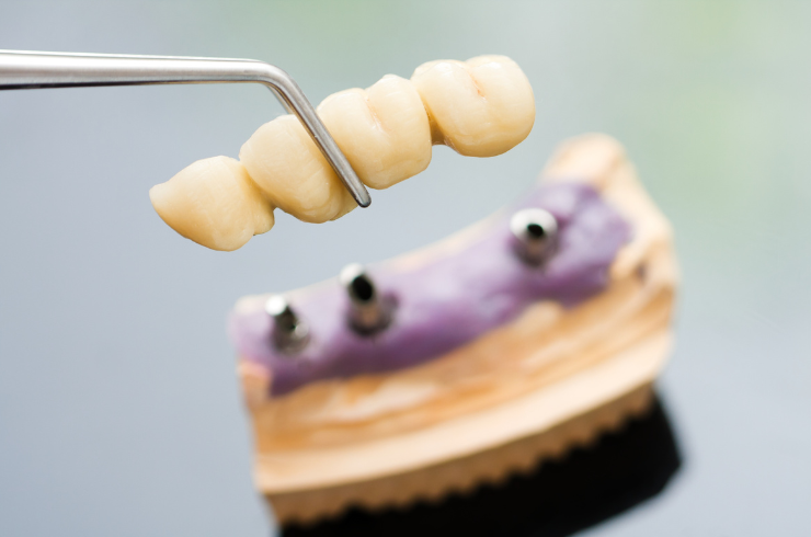 Reliable Superspeciality Dental Care