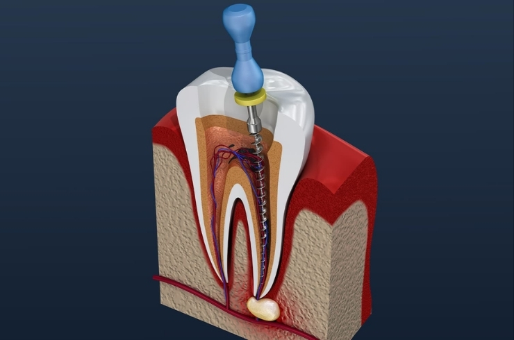 Reliable Superspeciality Dental Care
