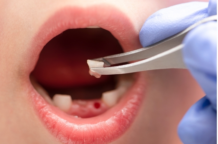 Reliable Superspeciality Dental Care